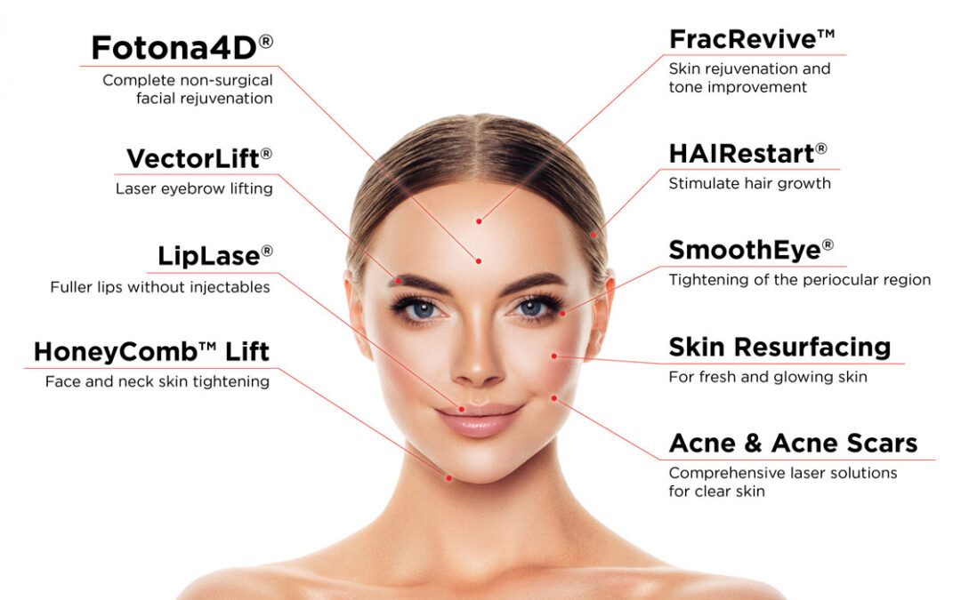 Laser Fotona: quais são os principais benefícios para a pele?