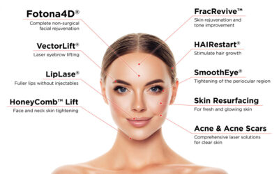Laser Fotona: quais são os principais benefícios para a pele?