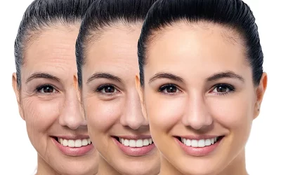 Rejuvenescimento de forma natural: o que realmente funciona na dermatologia